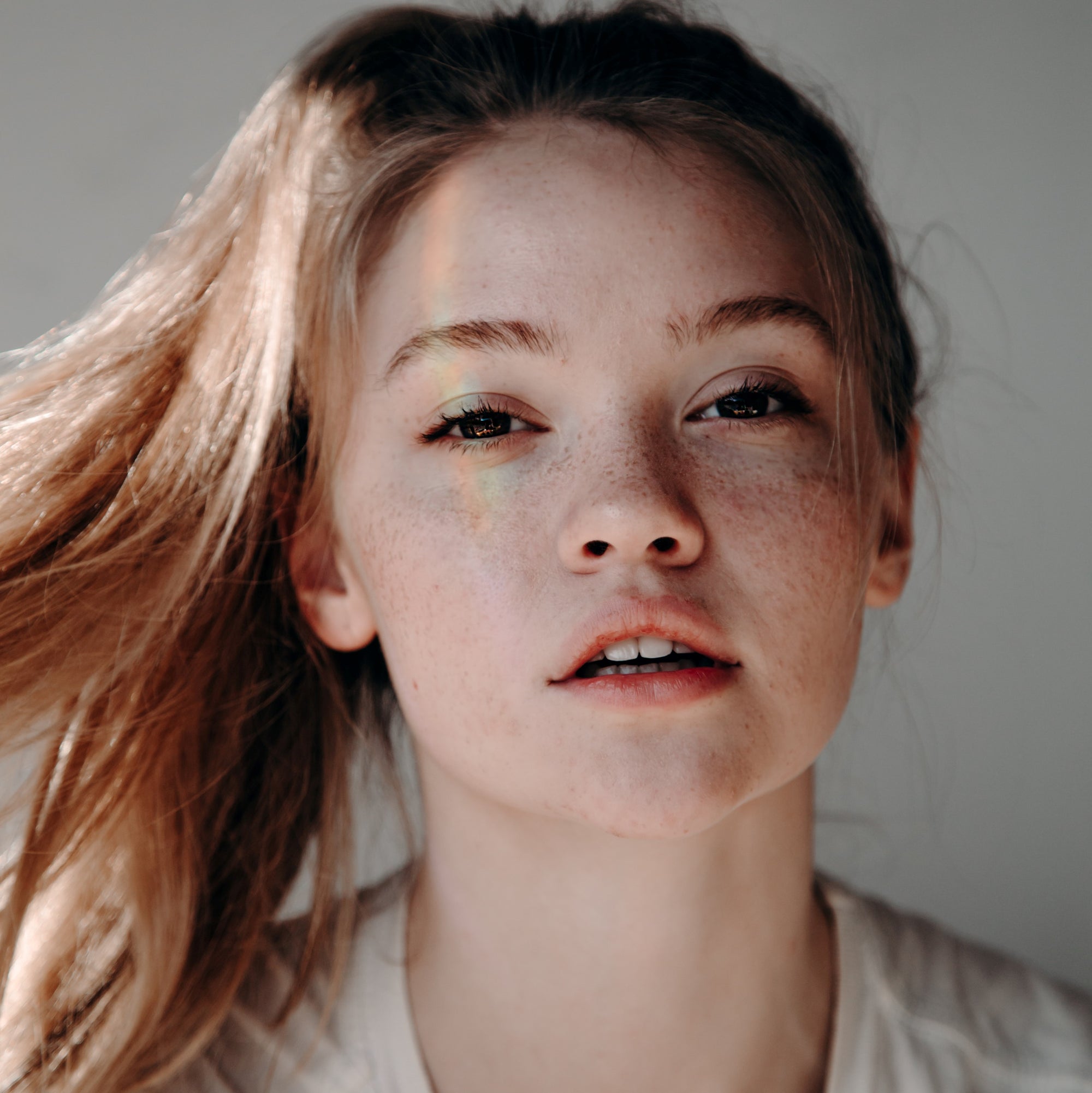 #ASKDRTIMM: HOW CAN I TREAT MY HYPERPIGMENTATION?